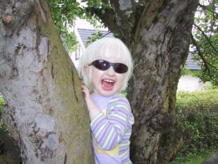 Lachend kind met albinisme dat een zonnebril draagt. Het meisje staat bij een boom.